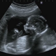 Illustration for article titled Doctors Let Woman Die Rather Than Harm Her Fetus